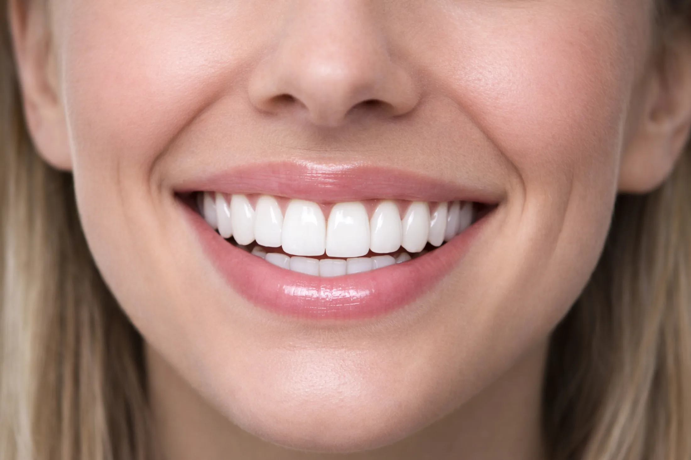 Gum rejuvenation at Rozenberg Dental, Midtown NYC